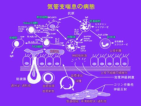 気管支喘息の病態